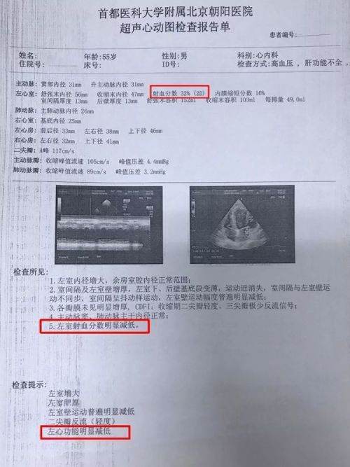 EF值是什么?来自