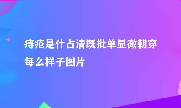 痔疮是什占清既批单显微朝穿每么样子图片