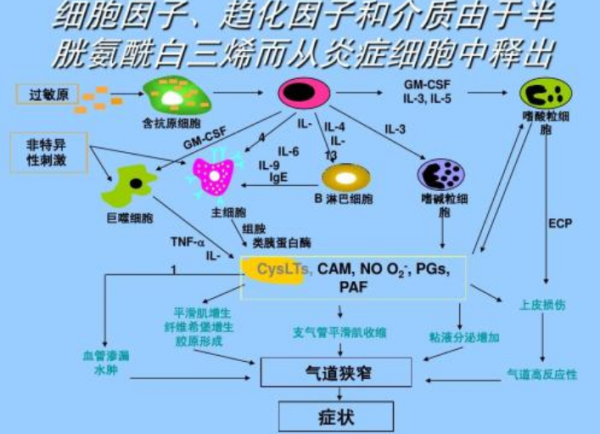 LT这样缩写是什么意思？