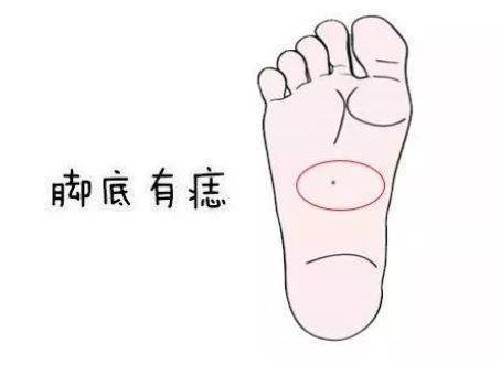 脚底有痣代表什么