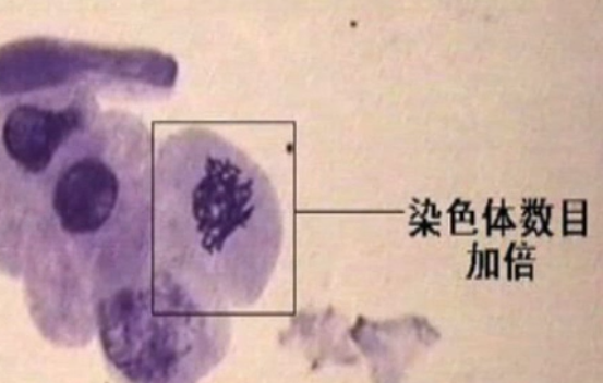 低温诱药怀导植物染色体数目变化的实验怎么做