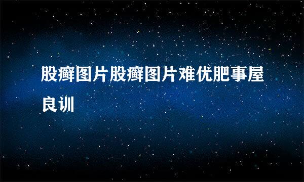 股癣图片股癣图片难优肥事屋良训