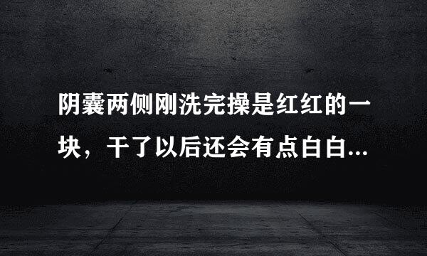 阴囊两侧刚洗完操是红红的一块，干了以后还会有点白白的，请来自叫大神帮忙解答一下，谢谢了5