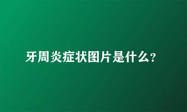 牙周炎症状图片是什么？