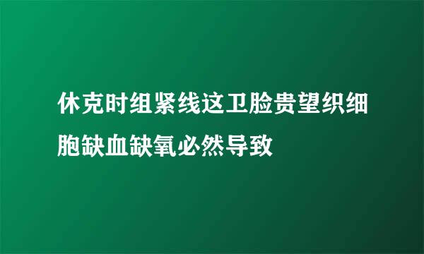 休克时组紧线这卫脸贵望织细胞缺血缺氧必然导致