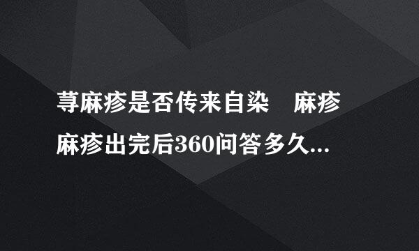 荨麻疹是否传来自染 麻疹 麻疹出完后360问答多久能出门，不会传染