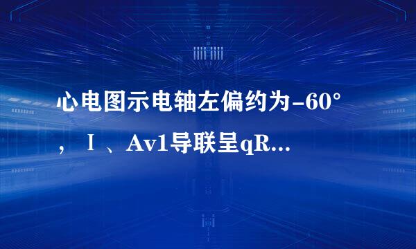 心电图示电轴左偏约为-60°，Ⅰ、Av1导联呈qR波型，Ⅱ、Ⅲ、AvF导联呈rS图型，QRS时限